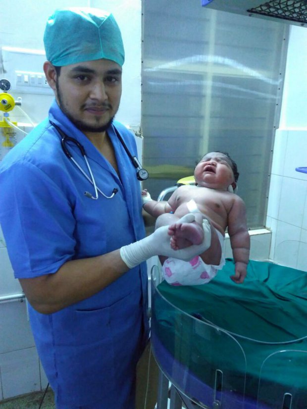 PIC FROM CATERS NEWS - (PICTURED: One of the doctors who helped deliver Nandinis baby.) - A mother has given birth to a baby girl weighing a whopping 15lbs - the heaviest female ever born in the world. Nandini, 19, who goes only by her initial name, welcomed her first child, a daughter, by cesarean section on Monday evening at a government-run hospital in Hassan in southern state Karnataka. The average baby is born weighing 7.5lbs - making Nadinis newborn female twice the size. SEE CATERS COPY.