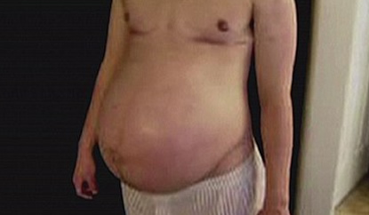 pregnant-man