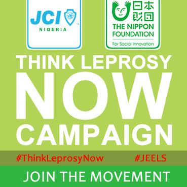 think leprosy now